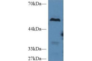 Western Blot; Sample: Mouse Liver lysate; Primary Ab: 2µg/ml Rabbit Anti-Mouse TAFI Antibody Second Ab: 0. (CPB2 anticorps  (AA 113-422))