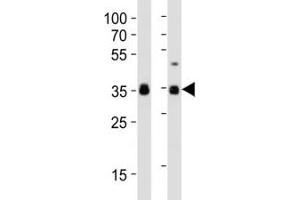 Western blot analysis of lysate from human NCCIT, mouse F9 cell line (left to right) using anti-SOX2 antibody at 1:1000 for each lane. (SOX2 anticorps  (AA 282-316))