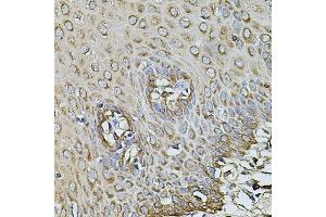 Immunohistochemistry of paraffin-embedded human esophagus using CPOX antibody. (CPOX anticorps  (AA 111-454))