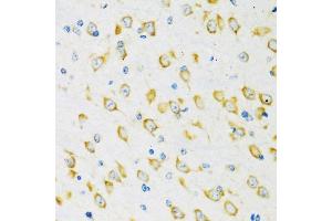 Immunohistochemistry of paraffin-embedded mouse brain using FMRP antibody (ABIN6133703, ABIN6140719, ABIN6140721 and ABIN6221705) at dilution of 1:100 (40x lens).