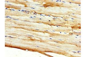 IHC image of ABIN7149882 diluted at 1:500 and staining in paraffin-embedded human skeletal muscle tissue performed on a Leica BondTM system. (DKK2 anticorps  (AA 34-259))