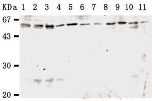Western Blotting (WB) image for anti-Karyopherin alpha 3 (Importin alpha 4) (KPNA3) antibody (ABIN1449200) (KPNA3 anticorps)