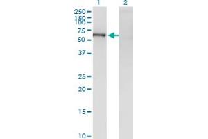 Western Blot analysis of ZNF192 expression in transfected 293T cell line by ZNF192 monoclonal antibody (M01), clone 1F2. (ZNF192 anticorps  (AA 1-90))