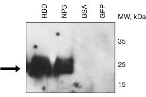 Binding of CR3022 to RBD and NP3 (fragment 3) of 2019nCoV proteins by Western blotting . (SARS-CoV-2 anticorps)