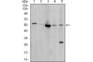 Western blot analysis using AKT1 mouse mAb against MCF-7 (1), NIH/3T3 (2), Hela (3), COS7 (4), and C6 (5) cell lysate.
