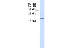Western Blotting (WB) image for anti-Sodium Channel, Voltage-Gated, Type III, beta Subunit (SCN3B) antibody (ABIN2461577) (SCN3B anticorps)