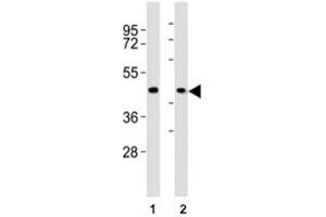 Western blot testing of CCR1 antibody at 1:2000 dilution.
