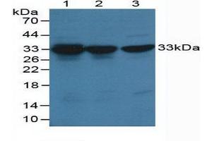 Western blot analysis of (1) Human HeLa cells, (2) Human Hepg2 Cells and (3) Human K-562 Cells. (CDK2 anticorps  (AA 5-346))