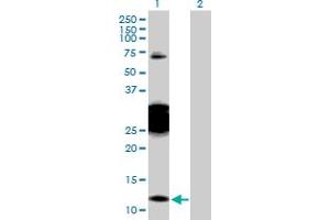 Western Blot analysis of CBY1 expression in transfected 293T cell line by CBY1 MaxPab polyclonal antibody. (CBY1/PGEA1 anticorps  (AA 1-126))