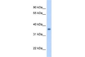 WB Suggested Anti-SGCG Antibody Titration:  1. (SGCG anticorps  (Middle Region))