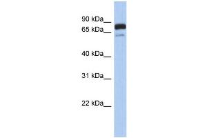 WB Suggested Anti-MTMR12 Antibody Titration: 0. (MTMR12 anticorps  (Middle Region))