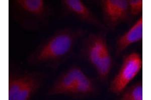 Immunofluorescence staining of methanol-fixed HeLa cells using MARCKS (Phospho-Ser162) Antibody (E011265, Red) (MARCKS anticorps  (pSer162))