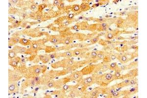 Immunohistochemistry of paraffin-embedded human liver tissue using ABIN7149206 at dilution of 1:100