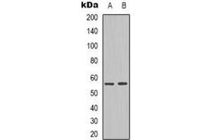 Western blot analysis of NPY5R expression in Jurkat (A), HepG2 (B) whole cell lysates.