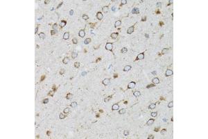 Immunohistochemistry of paraffin-embedded rat brain using UBE2D1 antibody (ABIN3015751, ABIN3015752, ABIN3015753 and ABIN6219101) at dilution of 1:100 (40x lens). (UBE2D1 anticorps  (AA 1-147))