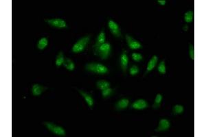 Immunofluorescence staining of Hela cells with ABIN7155794 at 1:133, counter-stained with DAPI.