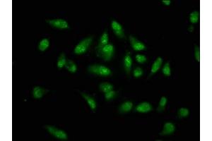 Immunofluorescence staining of Hela cells with ABIN7155794 at 1:133, counter-stained with DAPI. (MKX anticorps  (AA 157-305))