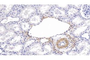 Detection of ACTC1 in Human Kidney Tissue using Monoclonal Antibody to Actin Alpha 1, Cardiac Muscle (ACTC1)