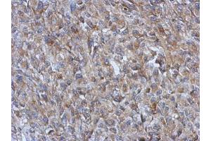 IHC-P Image Immunohistochemical analysis of paraffin-embedded RT2 xenograft, using GOT2, antibody at 1:500 dilution.