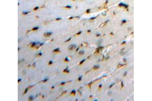 Used in DAB staining on fromalin fixed paraffin-embedded Heart tissue (HBEGF anticorps  (AA 21-160))
