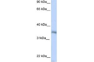 WB Suggested Anti-HEXIM2 Antibody Titration:  0. (HEXIM2 anticorps  (N-Term))