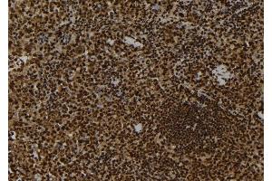 ABIN6263111 and ABIN6278722 at 1/100 staining Mouse spleen tissue by IHC-P. (MAP3K9 anticorps  (C-Term))