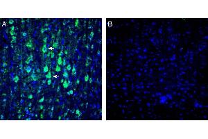 Expression of KCa2.