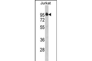 Western blot analysis of HTATSF1 Antibody (N-term) (ABIN390597 and ABIN2840915) in Jurkat cell line lysates (35 μg/lane). (HTATSF1 anticorps  (N-Term))