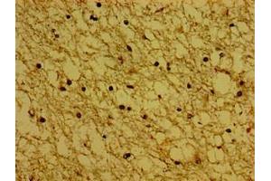 Immunohistochemistry of paraffin-embedded human brain tissue using ABIN7171138 at dilution of 1:100 (Synaptoporin anticorps  (AA 199-265))