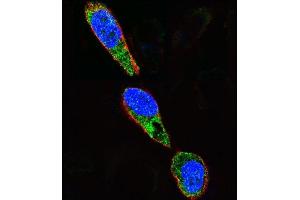 Confocal immunofluorescent analysis of SRC Antibody  (ABIN652537 and ABIN2842362) with  cell followed by Alexa Fluor 488-conjugated goat anti-rabbit lgG (green). (Src anticorps  (AA 397-424))
