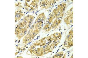 Immunohistochemistry of paraffin-embedded Human gastric using ARHGAP25 antibody.