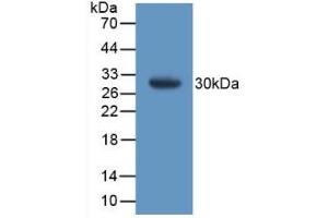 Detection of Recombinant GSTt1, Mouse using Polyclonal Antibody to Glutathione S Transferase Theta 1 (GSTt1) (GSTT1 anticorps  (AA 7-240))