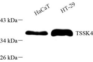 Western blot analysis of TSSK4 (ABIN7075865) at dilution of 1: 500 (TSSK4 anticorps)