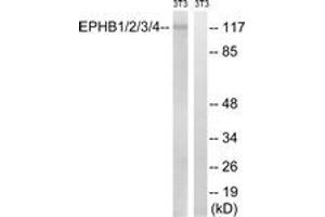 Western blot analysis of extracts from NIH-3T3 cells, treated with heat shock, using EPHB1/2/3/4 (Ab-600/602/614/596) Antibody. (EPH Receptor B1/2/3/4 (AA 566-615) anticorps)