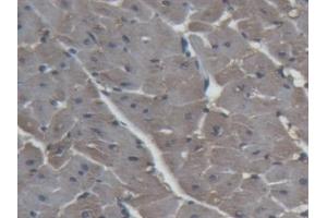 Detection of H-FABP in Porcine Heart Tissue using Polyclonal Antibody to Heart-type Fatty Acid Binding Protein (H-FABP)