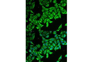 Immunofluorescence analysis of MCF-7 cells using DAP antibody. (DAP anticorps)