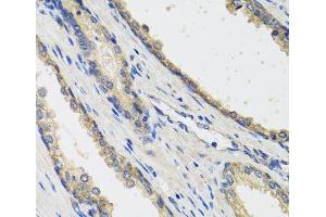 Immunohistochemistry of paraffin-embedded Human prostate using RAD51C Polyclonal Antibody at dilution of 1:100 (40x lens). (RAD51C anticorps)
