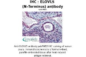 Image no. 2 for anti-ELOVL Fatty Acid Elongase 5 (ELOVL5) (N-Term) antibody (ABIN1733973) (ELOVL5 anticorps  (N-Term))
