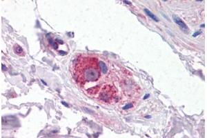 Human Small Intestine, Submucosal Plexus: Formalin-Fixed, Paraffin-Embedded (FFPE) (CYP26B1 anticorps  (AA 418-430))