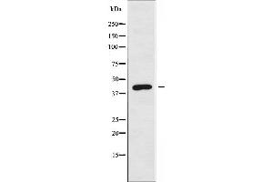 Western blot analysis of extracts from Jurkat cells using ARRDC3 antibody. (ARRDC3 anticorps  (C-Term))