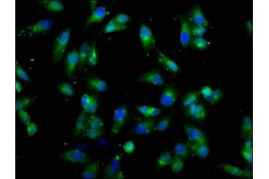 Immunofluorescence staining of Hela cells with ABIN7149290 at 1:66, counter-stained with DAPI.