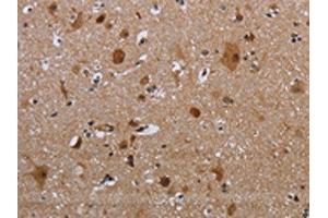The image on the left is immunohistochemistry of paraffin-embedded Human brain tissue using ABIN7191347(MAGEB18 Antibody) at dilution 1/20, on the right is treated with synthetic peptide. (MAGEB18 anticorps)