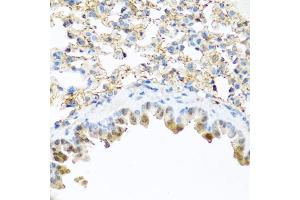 Immunohistochemistry of paraffin-embedded mouse lung using PI3 antibody (ABIN6132804, ABIN6145588, ABIN6145590 and ABIN6221092) at dilution of 1:100 (40x lens). (PI3 anticorps  (AA 23-117))
