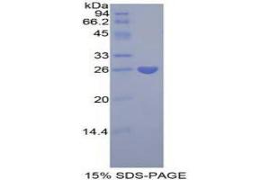SDS-PAGE analysis of Human Pentraxin 3 Protein.
