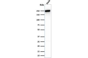 Western Blot Analysis of human HeLa cell lysate using Spectrin beta III Monoclonal Antibody (SPTBN2/1583).