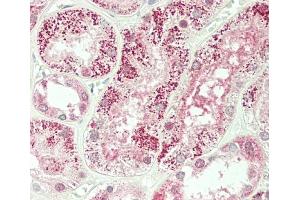 Formalin-fixed and paraffin-embedded H. (Plakophilin 4 anticorps  (C-Term))