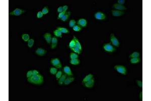 Immunofluorescent analysis of HepG2 cells using ABIN7167968 at dilution of 1:100 and Alexa Fluor 488-congugated AffiniPure Goat Anti-Rabbit IgG(H+L) (ARHGEF12 anticorps  (AA 1302-1501))