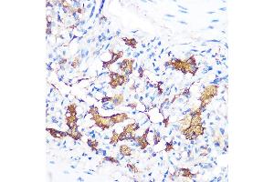 Immunohistochemistry of paraffin-embedded rat lung using FGF21 Rabbit mAb (ABIN1680154, ABIN3018263, ABIN3018264 and ABIN7101589) at dilution of 1:100 (40x lens).