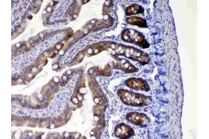 IHC analysis of HE4 using anti-HE4 antibody .