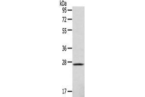 Gel: 10 % SDS-PAGE,Lysate: 40 μg,Primary antibody: ABIN7128967(CLEC4D Antibody) at dilution 1/123 dilution,Secondary antibody: Goat anti rabbit IgG at 1/8000 dilution,Exposure time: 1 minute (CLEC4D anticorps)